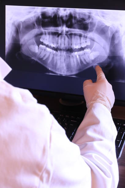 Best Emergency Dental Extractions in Concord, VA