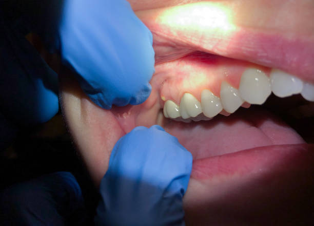 Best Emergency Root Canal Treatment in Concord, VA