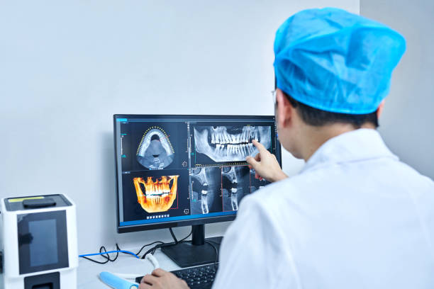 Best Emergency Dentist for Lost Fillings or Crowns in Concord, VA