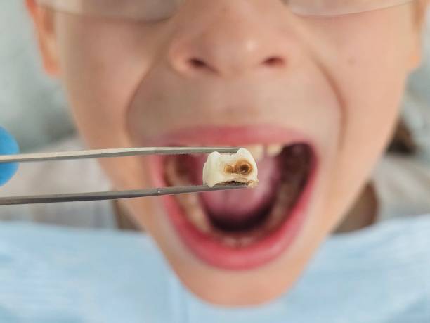 Best 24-Hour Emergency Dentist in Concord, VA